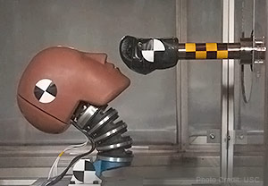 Head Injury Prevention